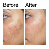 The Inkey List Serum The Inkey List Ectoin Hydro-Barrier Serum 30ml