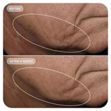 Vol.U.Lift Serum VOL.U.LIFT 4D Skin Rebound Complex