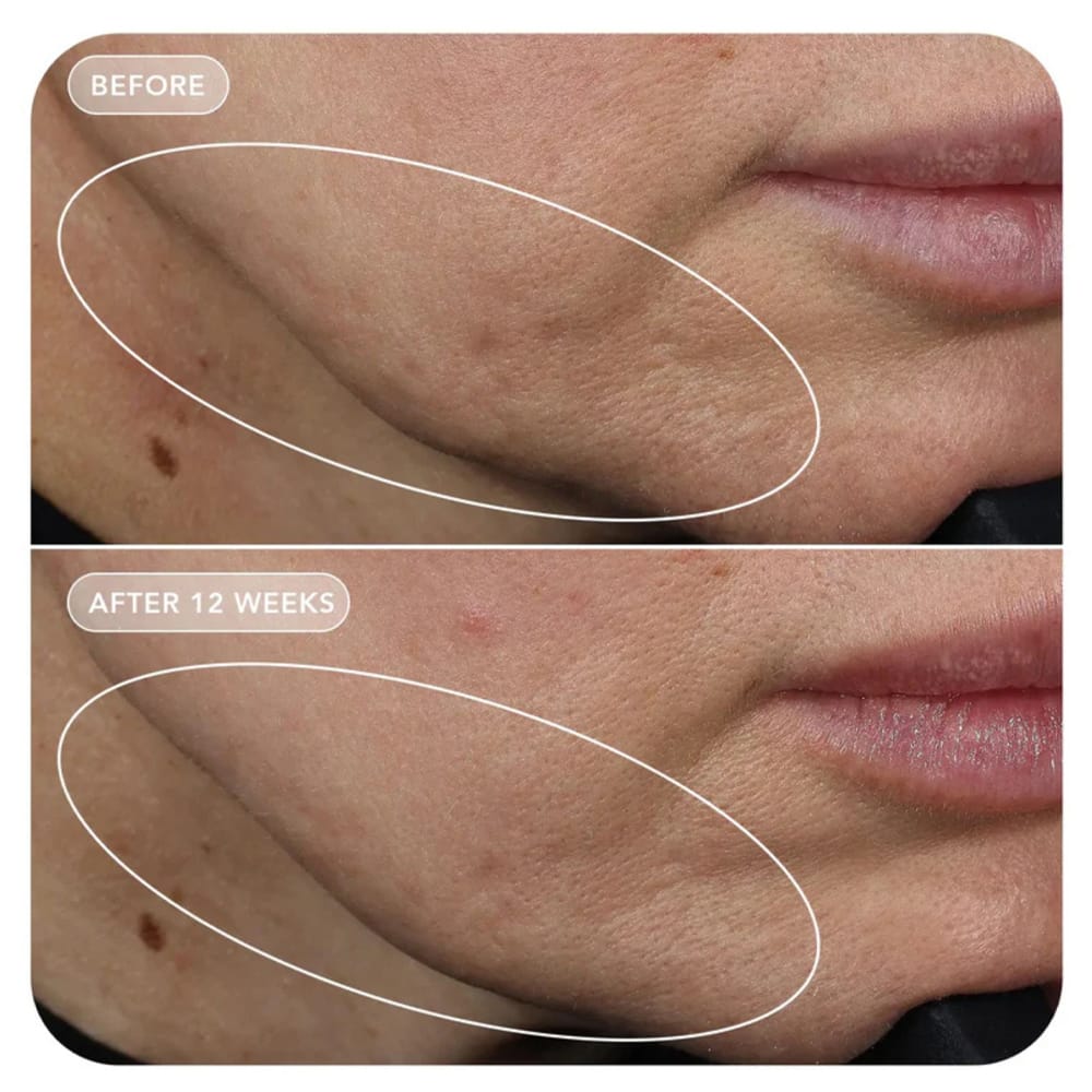 Vol.U.Lift Serum VOL.U.LIFT 4D Skin Rebound Complex