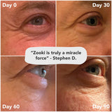 Zooki Vitamins & Supplements Zooki Marine Collagen Variety Pack